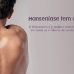 hanseníase tem cura